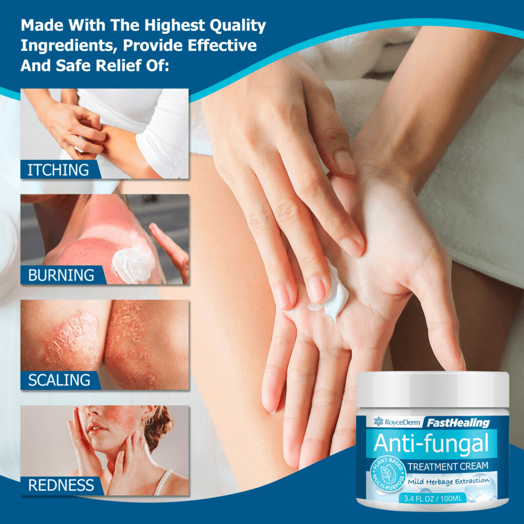 RoyceDerm FastHealing Anti-fungal Treatment Cream shown relieving symptoms of itching, burning, scaling, and redness. The product is applied to hands and promotes effective relief using high-quality ingredients, featured in a 100ml jar with mild herbage extraction.