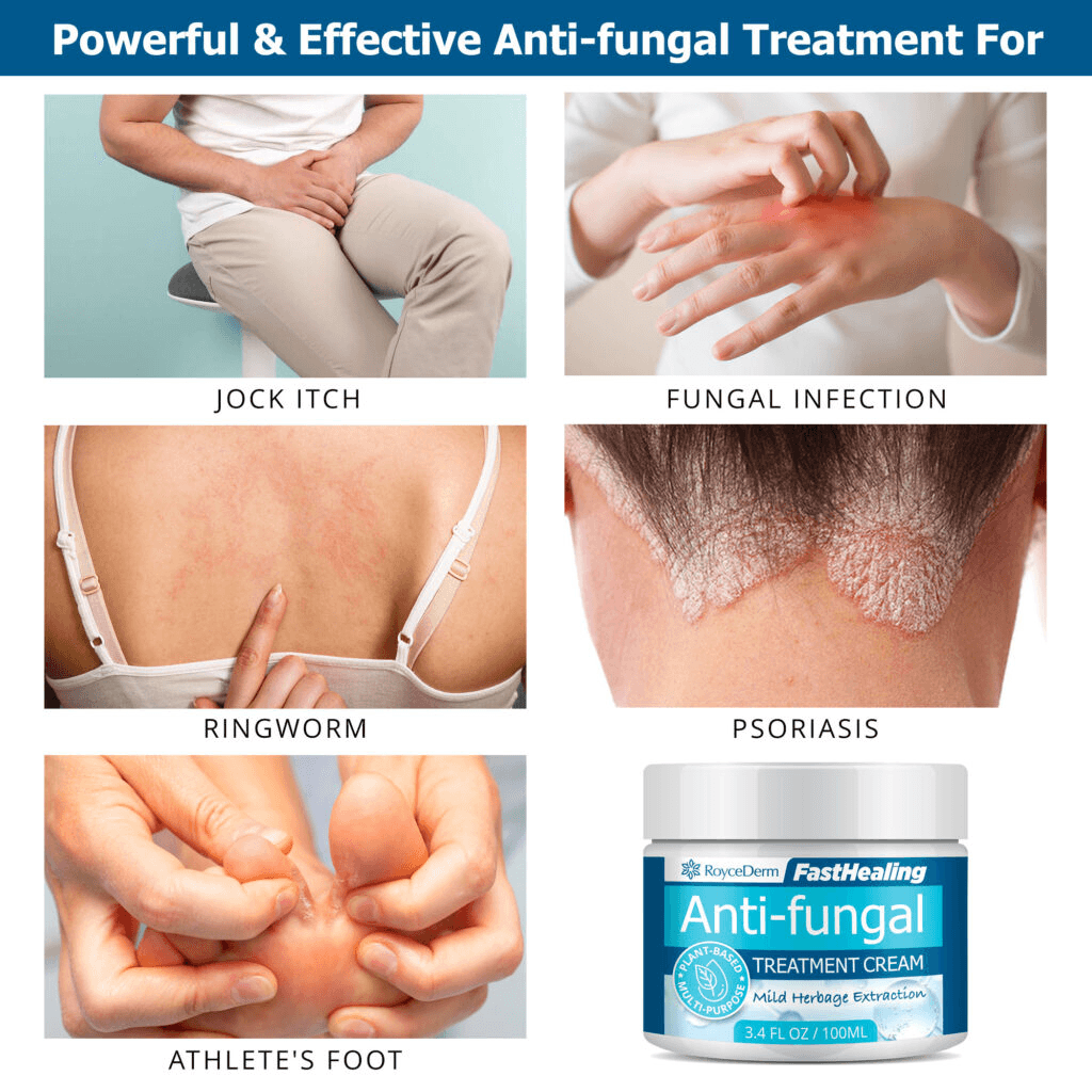 RoyceDerm FastHealing Anti-fungal Treatment Cream displayed with images of common fungal conditions: jock itch, fungal infection, ringworm, psoriasis, and athlete’s foot. The cream, shown in a 100ml jar, provides powerful and effective treatment for these skin issues.