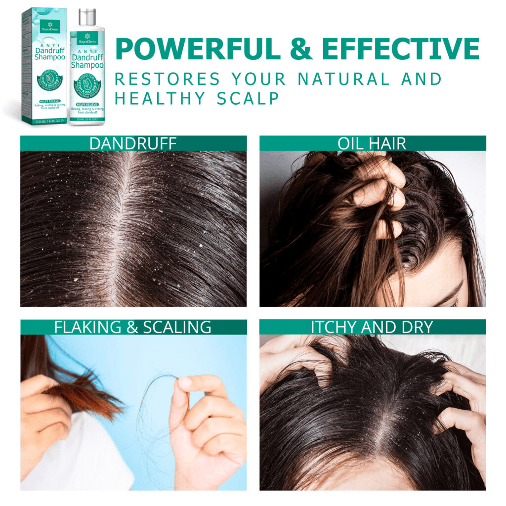 Dandruff Shampoo
