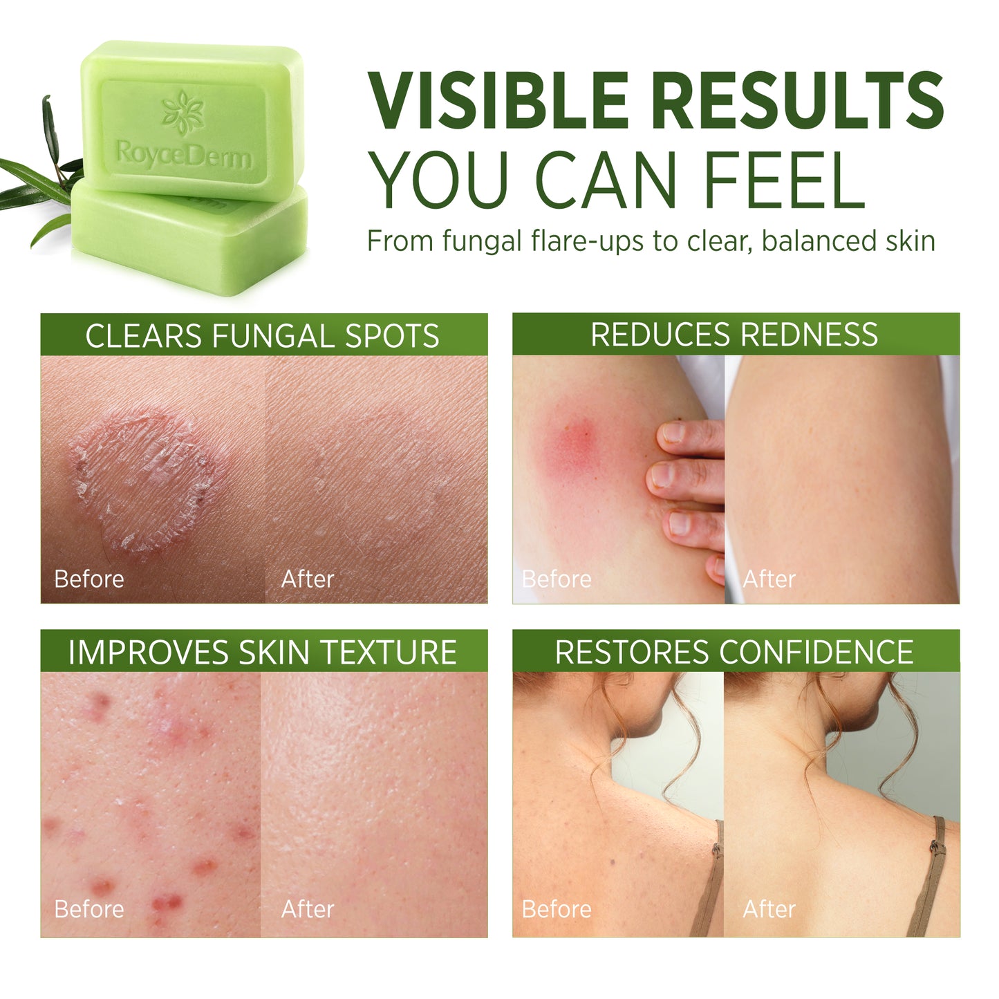 Tea Tree Oil Antifungal Soap