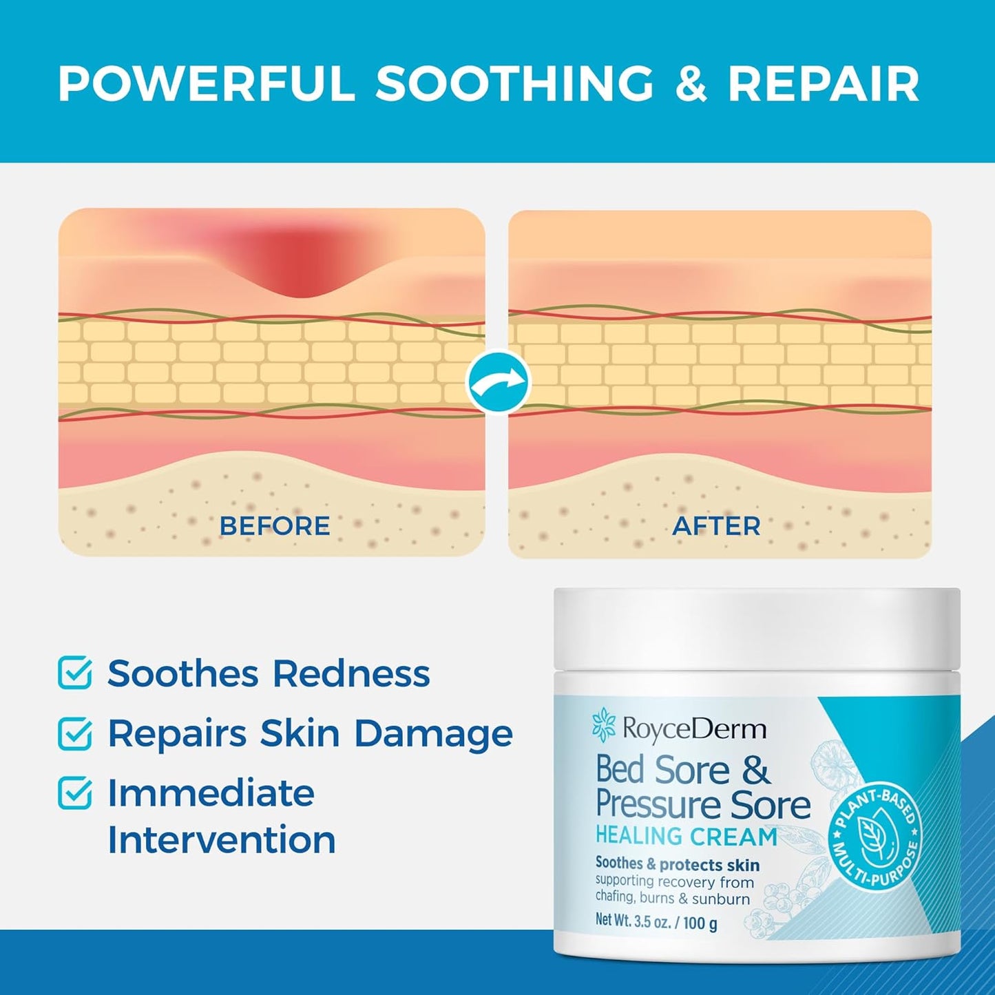 Bed and Pressure Sore Treatment Cream