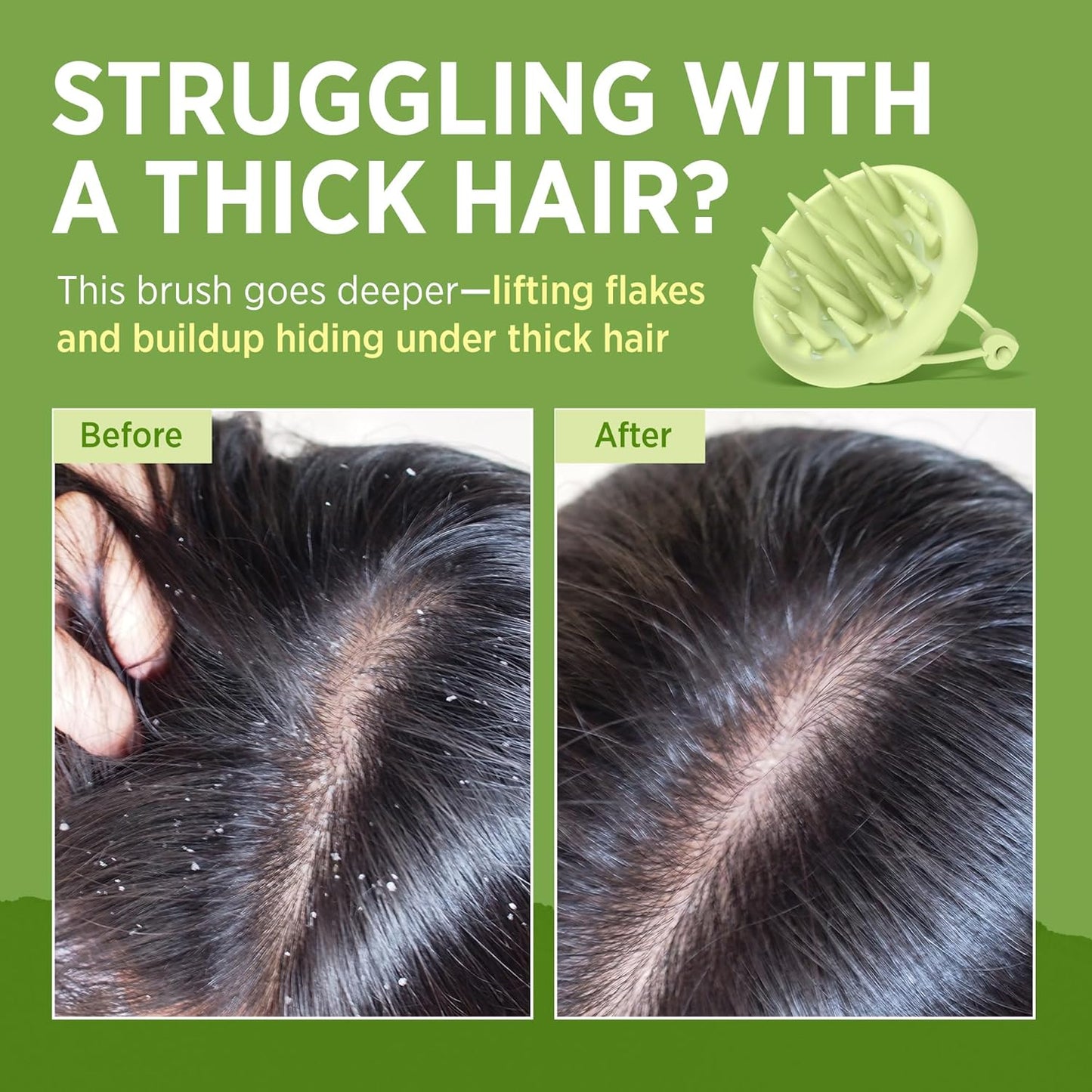 Scalp Massager Brush