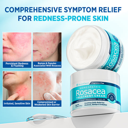 Rosacea Treatment Cream