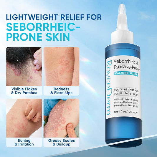 Roycederm Seborrheic Dermatitis Calming Serum shown treating redness, flakes, and irritation on arms and legs for seborrheic-prone skin.