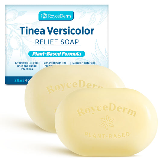 Tinea Versicolor Soap