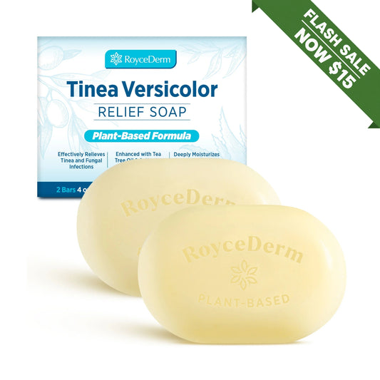 Tinea Versicolor Soap