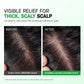 Scalp Psoriasis Treatment Spray