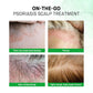 Scalp Psoriasis Treatment Spray