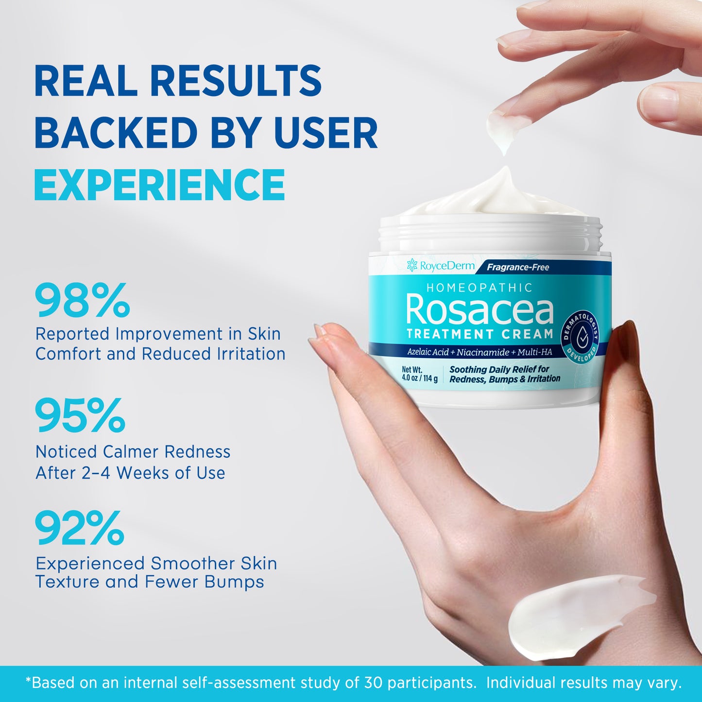 Rosacea Treatment Cream