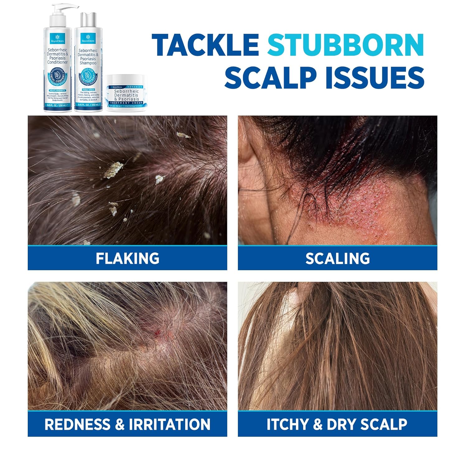 Seborrheic Dermatitis & Psoriasis Relief Trio