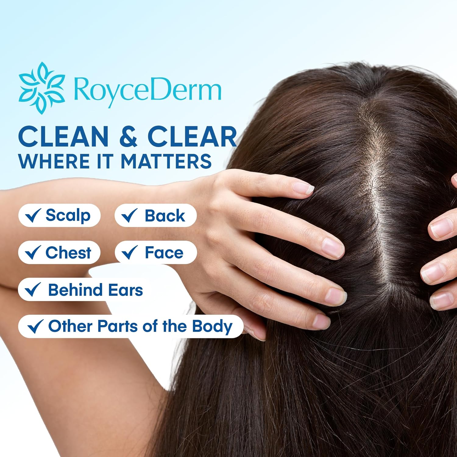 Roycederm Calming Serum applied to scalp, back, chest, face, and other areas to treat seborrheic dermatitis and psoriasis symptoms effectively.
