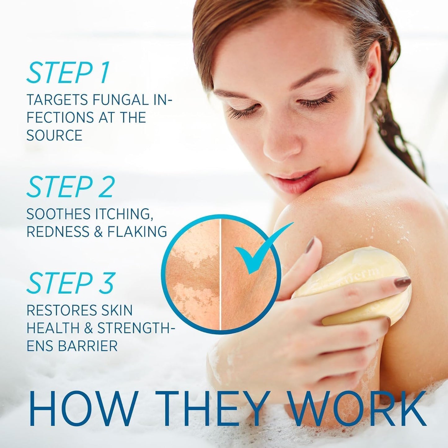 Tinea Versicolor Relief Cream & Soap Kit