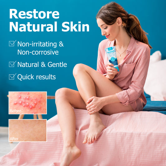 Herpe Treatment Cream: Natural, Gentle Relief for Genital Herpe Symptoms in Women - 2 oz