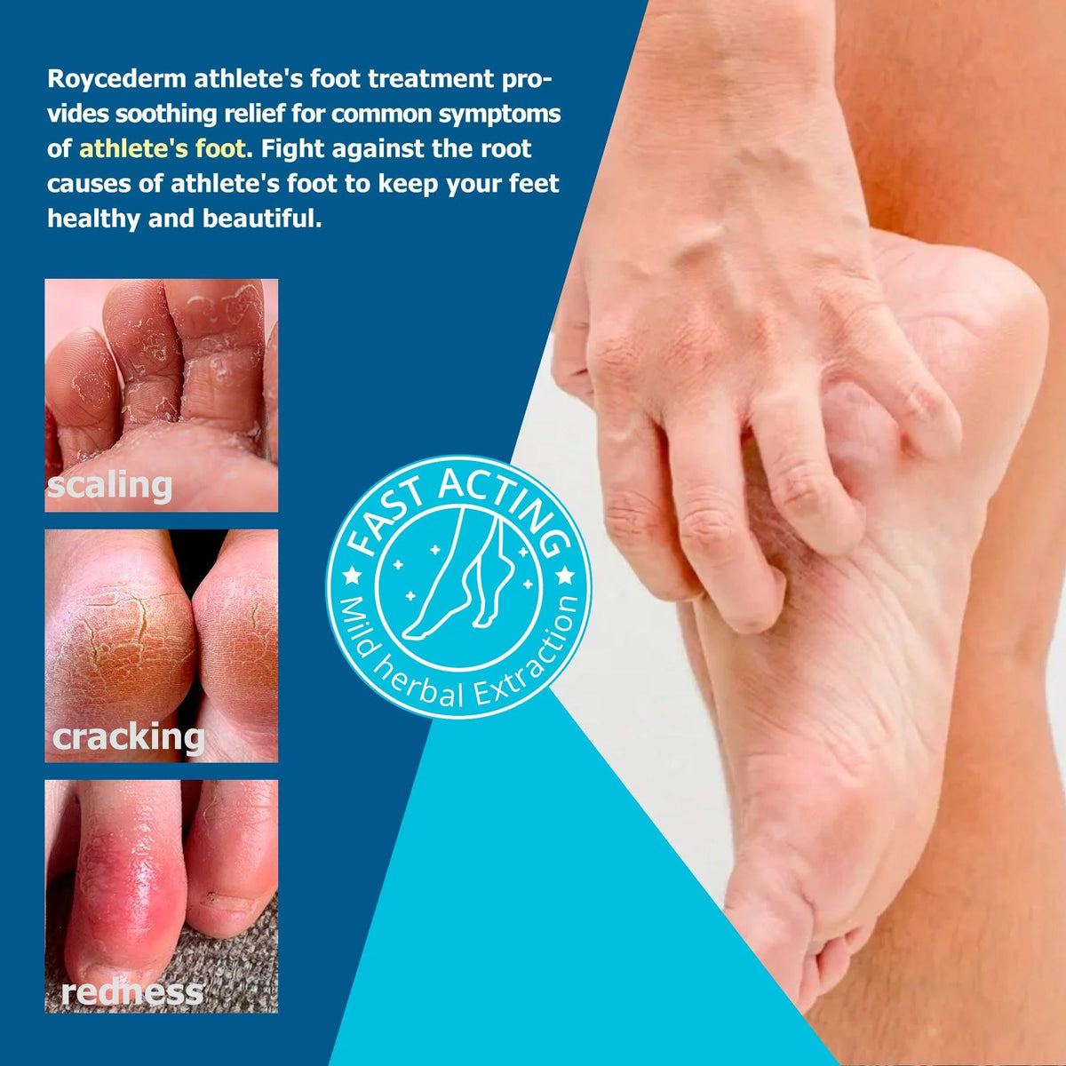 Complete 3-Step Athlete's Foot System
