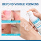 Rosacea-Prone Skin Calming Gel
