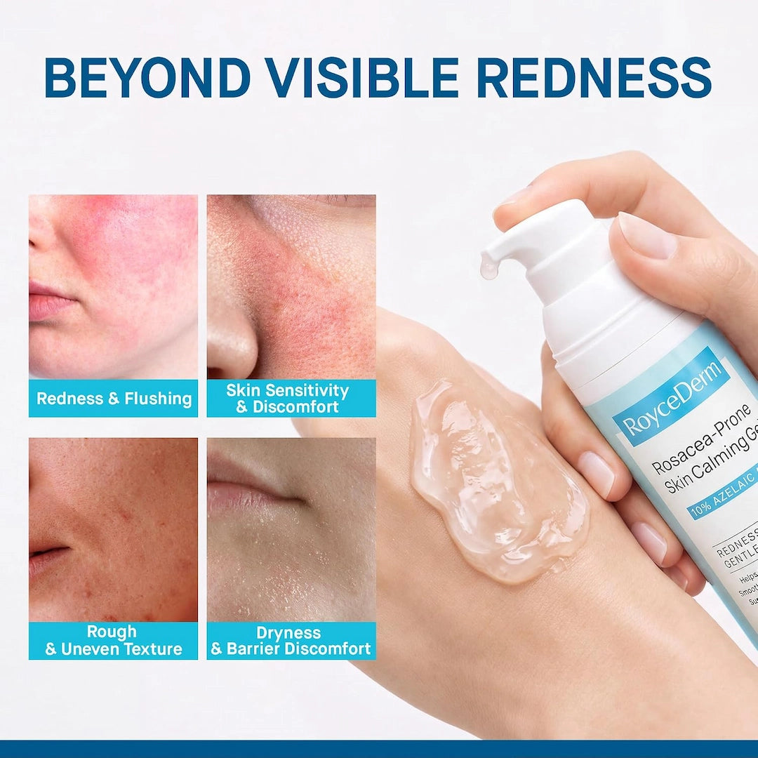 Rosacea-Prone Skin Calming Gel