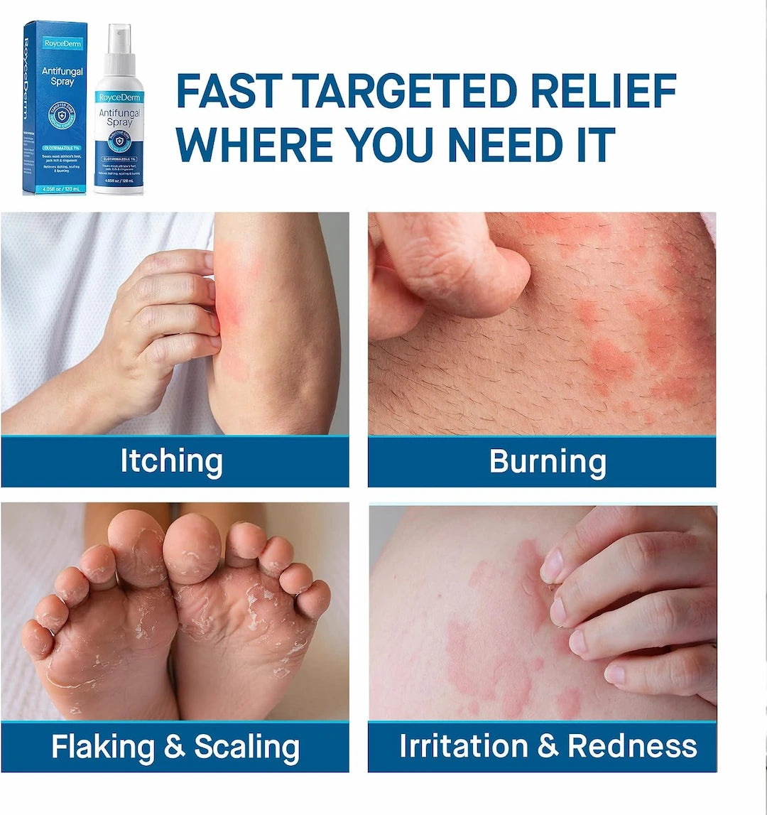 Antifungal Spray for Athlete's Foot & Jock Itch
