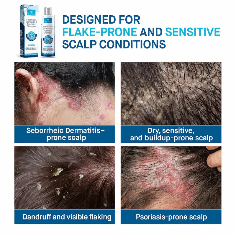 Seborrheic & Psoriasis Shampoo - Made in USA
