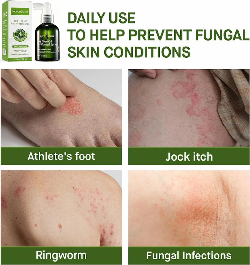 Tea Tree Antifungal Spray